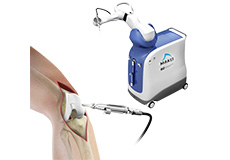 Robotic Assisted Partial Knee Surgery